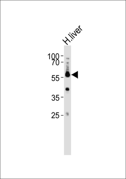 Cytochrome P450 27A1 Antibody