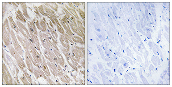 ACAD10 Antibody