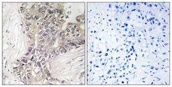 B3GALTL Antibody
