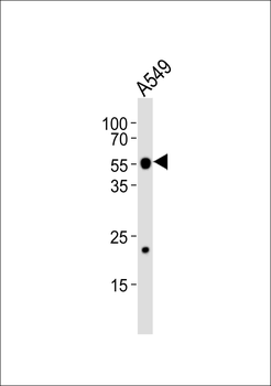 LPCAT2 Antibody