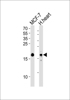PPP1R14C Antibody