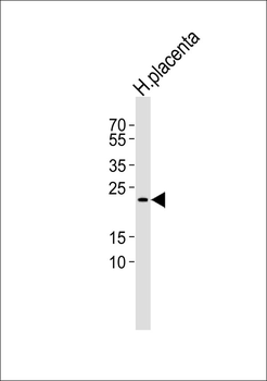 DUSP22 Antibody