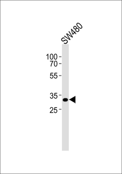 CEP76 Antibody