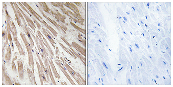 ARPP21 Antibody