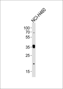 SLC39A1 Antibody