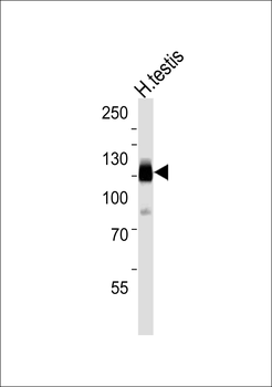 CABYR Antibody