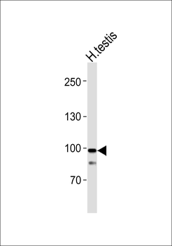 ABCA5 Antibody