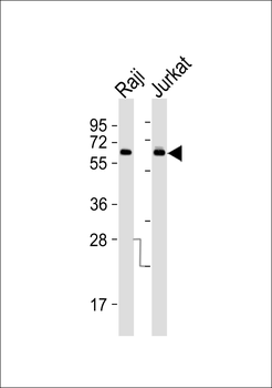 ABCD4 Antibody