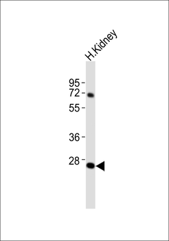 ABHD12B Antibody