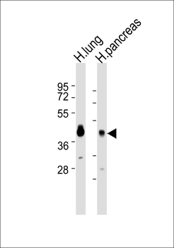 Apolipoprotein L2 Antibody