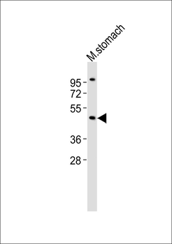 ARRDC1 Antibody