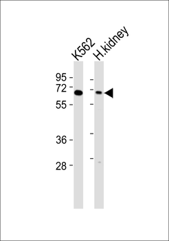 Arylsulfatase D Antibody