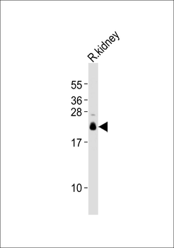 Claudin 10 Antibody