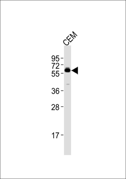 CSRNP2 Antibody