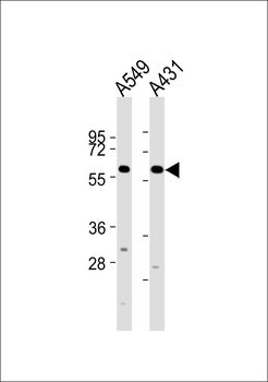 Cytochrome P450 2J2 Antibody