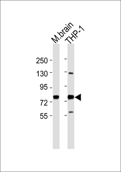 GUCY1A3 Antibody