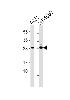 MRPL10 Antibody