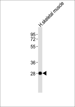 NEURL2 Antibody