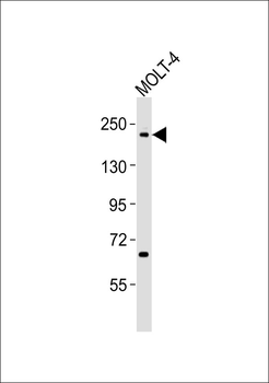 Topoisomerase 2 beta Antibody