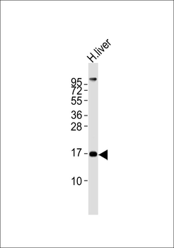 MGST2 Antibody