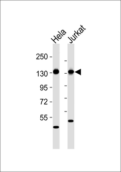 RAB3GAP1 Antibody