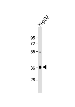 GHITM Antibody