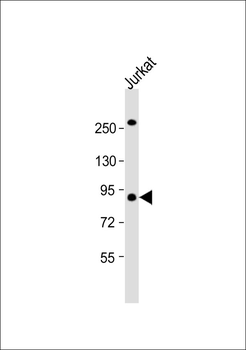 LTK Antibody