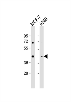 MVK Antibody