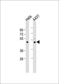 PABPC5 Antibody