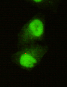 KDM5C / Jarid1C / SMCX Antibody