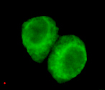 JMJD6(N-terminus) Antibody