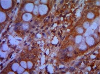 CHD3 (C-terminus) Antibody