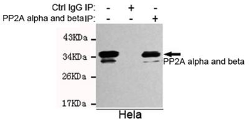 PP2A alpha and beta Antibody