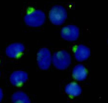 RanBP9 Antibody