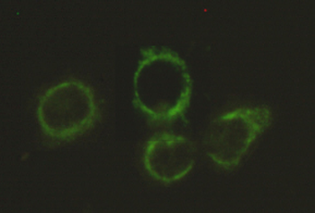 Pyruvate Dehydrogenase E2 Antibody
