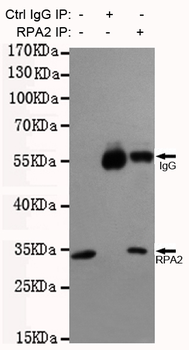 RPA32/RPA2 Antibody