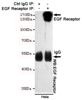 EGF Receptor Antibody
