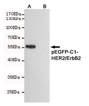 Anti-HER2/ErbB2 Antibody