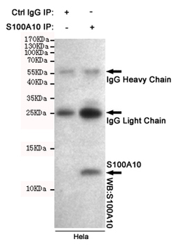 Anti-S100A10 Antibody
