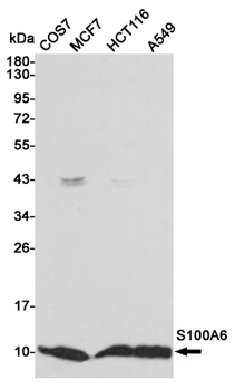 Anti-S100A6 Antibody