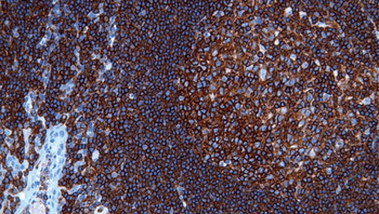 CD45