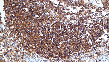 HLA-DR