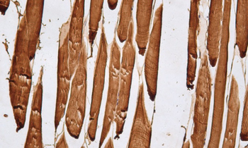 Myoglobin