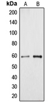 Anti-Cytochrome P450 4A11/22 Antibody