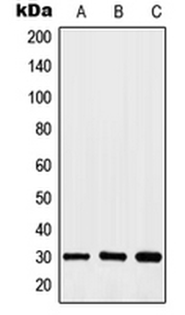 Anti-HOXA11/D11 Antibody