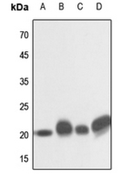 Anti-NRAS/HRAS/KRAS Antibody
