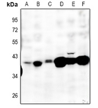 Anti-MT-ND2 Antibody