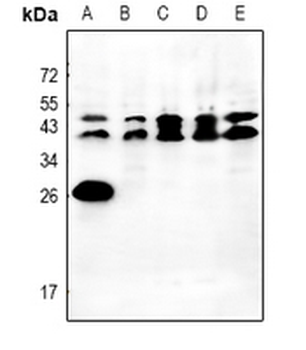 Anti-Orosomucoid 2 Antibody