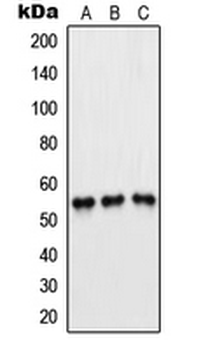 Anti-PFKFB1/4 Antibody
