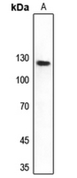 Anti-DNA Polymerase delta 1 Antibody